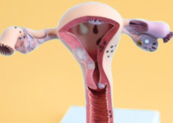 Abril Roxo: quais são as possibilidades de tratamento da adenomiose?