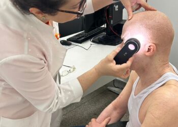 Albinismo: Mutação genética que afeta a melanina