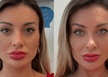 Andressa Urach diz ter se arrependido de procedimento para mudar cor dos olhos
