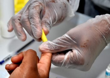 Dia D: Ambulatórios de Hepatites Virais em Salvador intensificam oferta para testagem na sexta (12)