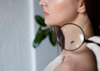 Uso do protetor solar é fundamental para prevenção do câncer de pele mesmo nos dias nublados ou no inverno