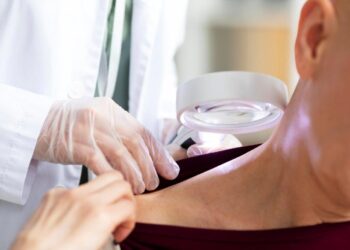 Junho Preto: melanoma, tipo mais agressivo e letal de câncer de pele, tem grande capacidade de formar metástases