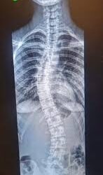 Hospital Ortopédico do Estado da Bahia disponibiliza exame inédito no SUS para diagnóstico de alterações ósseas