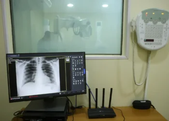 Brasil tem aumento de hospitalizações por Influenza A, alerta Fiocruz