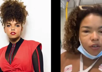 Jeniffer Nascimento tem reação alérgica e vai para o hospital após comer lagosta