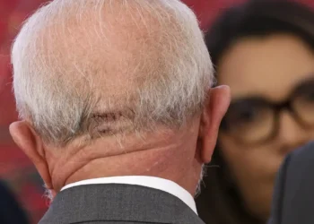 Lula faz exames em Brasília e apresenta quadro estável