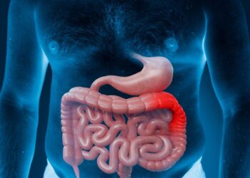 Março Azul-Marinho: especialistas alertam sobre importância da alimentação saudável e da colonoscopia para prevenção do câncer colorretal