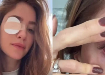 Esposa de Alok, médica Romana Novais, sofre lesão ocular após procedimento nos cílios: “Traumatizante”