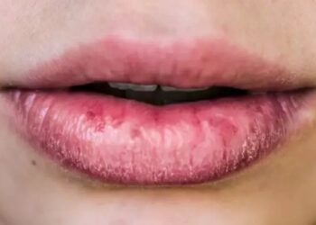 CRO Bahia lança campanha de prevenção de câncer em lábios