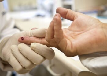 Bahia registra mais de 3 mil casos de HIV/Aids em 2024