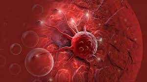 SUS pode gastar R$ 7,84 bi em 2040 com tratamento de câncer, diz Inca