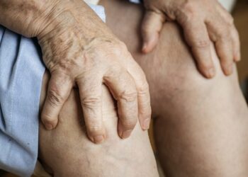 Trombose: doença silenciosa e perigosa que merece atenção e cuidados