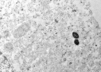 Argentina descarta mpox em tripulante de navio que saiu do Brasil