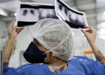 Câncer de pulmão: 15% dos casos acontecem em não fumantes