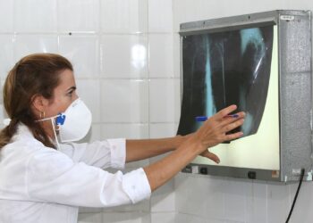 Baixo financiamento mundial ameaça combate à tuberculose