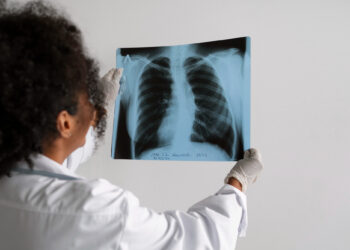 Número de casos de câncer de pulmão cresce entre não fumantes e mulheres