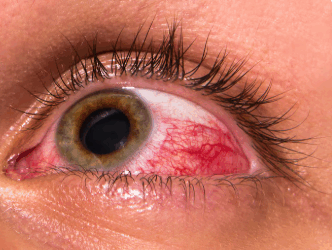 Seus olhos estão te dando um alerta?