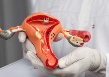 40% das mulheres com Síndrome dos Ovários Policísticos podem ter dificuldade para engravidar