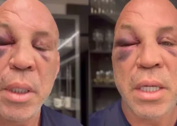Wanderlei Silva relata dores e problemas de memória dois dias após briga com Popó: “Muito chateado”