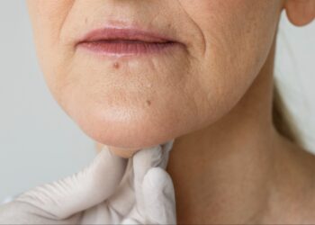 Rosto rejuvenescido sem cirurgia ou injetáveis: conheça três procedimentos inovadores não invasivos