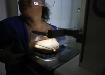 ANS defende que plano cubra mamografia digital sem restrição de idade