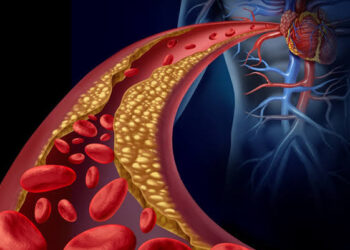 Controle do colesterol deve começar na infância, alerta cardiologista