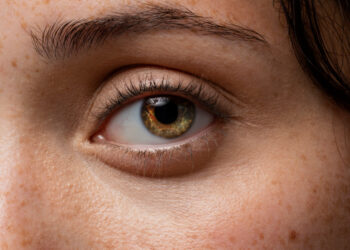 Dor ao movimentar os olhos e alteração nas cores são alerta de neuropatia óptica