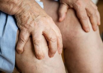 Trombose: entenda em quais situações a falta de movimento pode favorecer a formação de coágulos