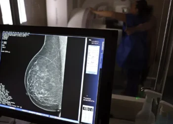 Plano de saúde terá que cobrir mamografia digital para todas as idades