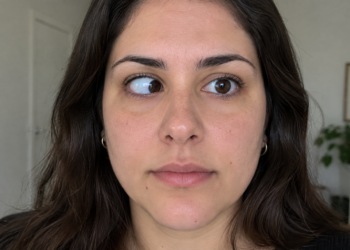 Estrabismo: veja como o uso de telas pode influenciar a saúde dos olhos
