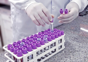 Setembro Vermelho: exames de sangue ajudam a identificar riscos cardiovasculares antes dos sintomas